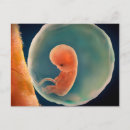 Search for foetus postcards Medical