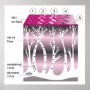 Search for progression posters Disease