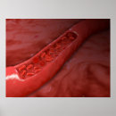 Search for blood art Artery