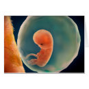 Search for placenta Pregnant