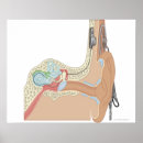 Search for implants posters Medical
