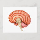 Search for temporal Cerebrum