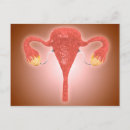 Search for cavity postcards Healthcare