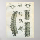 Search for spine posters Spinal