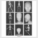 Search for skeleton xrays Anatomy