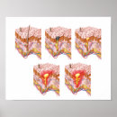 Search for corpuscle Colour image