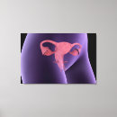 Search for side view canvas prints Detail