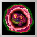 Search for foetus posters Childbirth