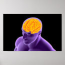 Search for human brain posters Head