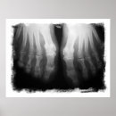 Search for human skeleton posters Bones