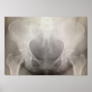 Search for xray bones posters Doctor