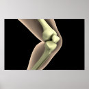 Search for knees posters Medical