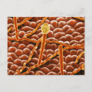 Search for false postcards Electron micrography