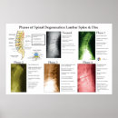 Search for chiropractic posters Chiropractor