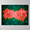 Search for oncology art Pathology