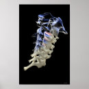 Search for cervical posters Work