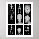 Search for human skeleton posters Skeletal