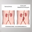 Search for aortic Medical