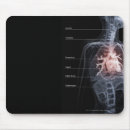 Search for human internal organ electronics View