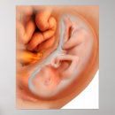 Search for foetus posters Development