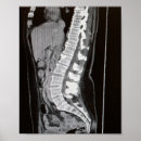 Search for mri Medical