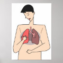 Search for lung posters Disease