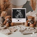 Search for ultrasound postcards Coming soon