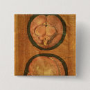 Search for anatomical badges Aquapendente