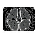 Search for mri magnets Brain