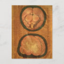 Search for anatomically postcards Aquapendente