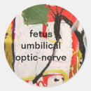 Search for optic stickers Abstract