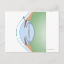 Search for surgery posters Work