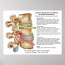 Search for chiros art Spine