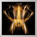 Search for spine art Health