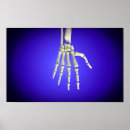 Search for human bones posters Detail