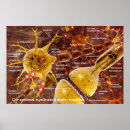 Search for neuron posters Nerve