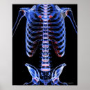 Search for x ray bones posters Work