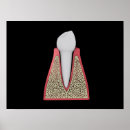Search for molar posters Human teeth