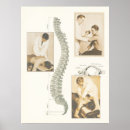 Search for chiropractic posters Chiropractor