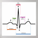 Search for ecg posters Electrocardiogram
