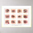 Search for eye chart art Optometry