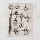 Search for medical diagram postcards Antique