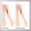 Search for muscularity posters Anatomy