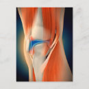Search for joint postcards Medical