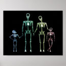 Search for wierd posters X ray