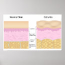 Search for skin care posters Dermatology