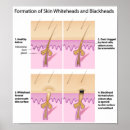 Search for skin care posters Dermatologist