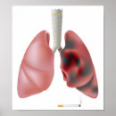 Search for chest art Anatomy