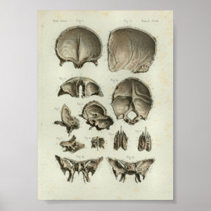 1844 Vintage Anatomy Print Skull Bones
