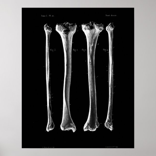 1844 Vintage Anatomy Print Tibia Fibula (Front)